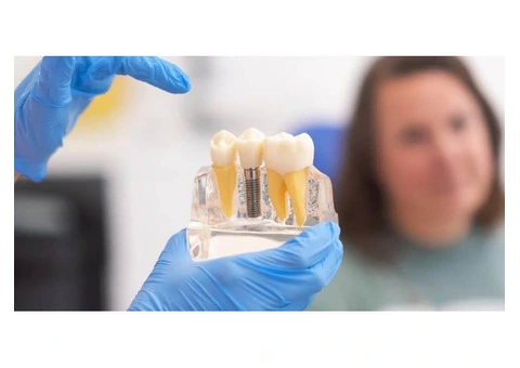 Dental Implant Specialists in Port Macquarie