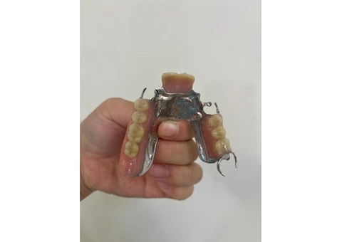 Affordable Denture Repairs in Strathfield | Quick & Reliable Service