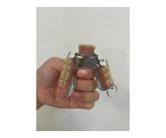 Affordable Denture Repairs in Strathfield | Quick & Reliable Service