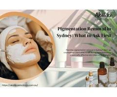 Pigmentation Removal in Sydney: What to Ask First