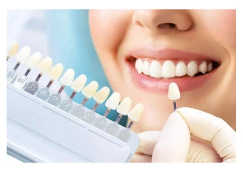 Dental implants winthrop