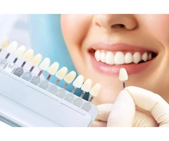 Dental implants winthrop