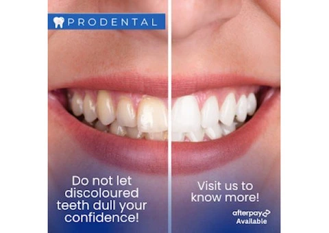 Reliable Dentist in Baulkham Hills – Prodental Clinic - 4/5