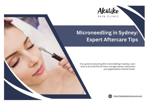 Microneedling in Sydney: Expert Aftercare Tips