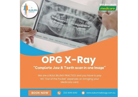 OPG X-Ray: Complete Jaw & Teeth Scan in One Image at Auburn Radiology. (02) 8315 8292