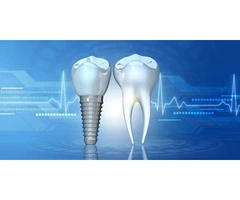 Sculpted Smiles Reimagined: Advanced Orthodontics in Liverpool for Precision Alignment