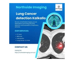 Lung Cancer Kalkallo