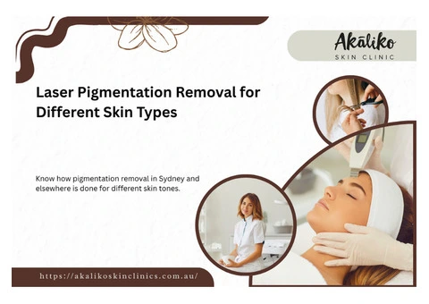 Pigmentation Removal for Different Skin Types: Role of Laser Skin Treatment