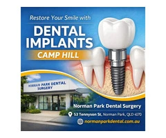 Quality Tooth Replacement Solutions with dental implants camp hill by Norman Park Dental Surgery