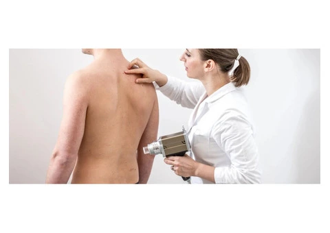Begin Your Path to Clearer Skin with Cyst Removal Treatment