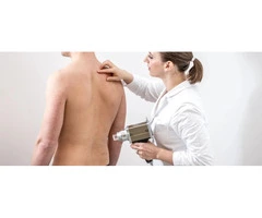 Begin Your Path to Clearer Skin with Cyst Removal Treatment