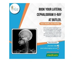 Book a Lateral Cephalogram at Butler Medical Imaging. (08) 9544 3999
