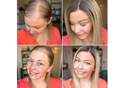 Transform Your Look with Seamless Integrated Hair System for Women in Perth