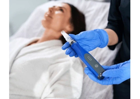 Skin Needling Sydney