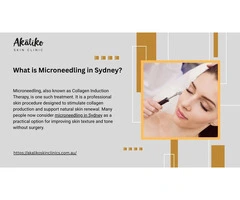 What is Microneedling in Sydney?