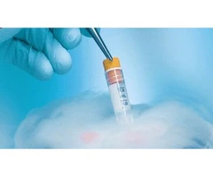 The IUI Process in Melbourne Made Simple and Stress-Free