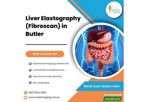 Liver Elastography (Fibroscan) at Butler Medical Imaging. (08) 9544 3999