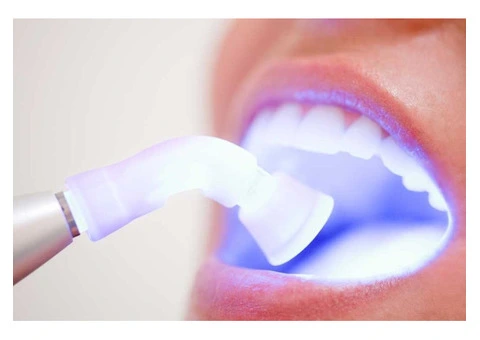 Get a Confident Smile with Teeth Whitening Melbourne Now