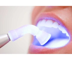 Get a Confident Smile with Teeth Whitening Melbourne Now
