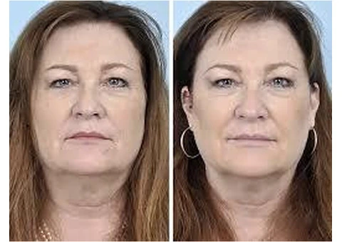 Restore Firmness Naturally with Advanced Vaginal Tightening Options