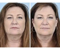 Restore Firmness Naturally with Advanced Vaginal Tightening Options