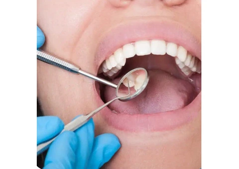 Dental Veneers Penrith