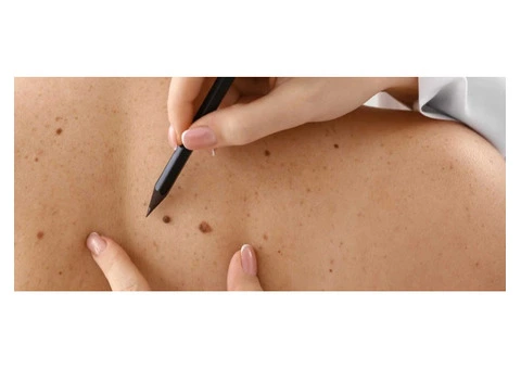 Explore Keloid Scar Treatment Procedures Assessed by Qualified Practitioners