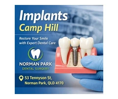 Quality Care for Implants Camp Hill at Norman Park Dental Surgery