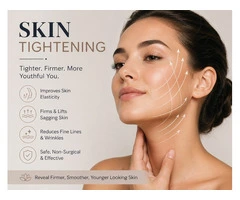 Skin Tightening Melbourne – Restore Your Glow