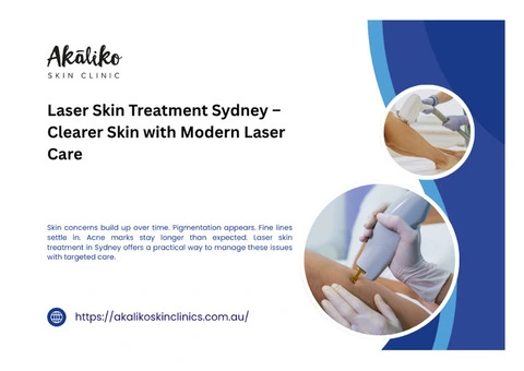 Laser Skin Treatment Sydney – Clearer Skin with Modern Laser Care