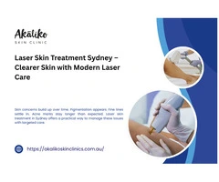Laser Skin Treatment Sydney – Clearer Skin with Modern Laser Care