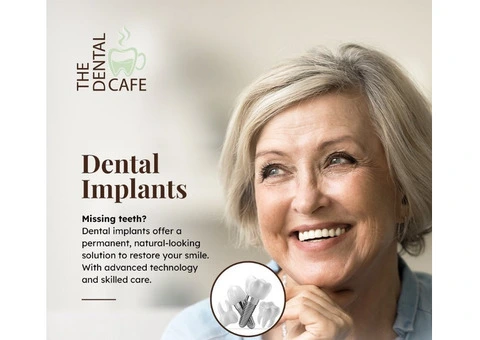 Dentist Camp Hill & Rochedale South | The Dental Cafe Brisbane - 3/3