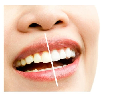 Dentist Forest Hill Brentford Dental Family and Cosmetic Care - 1/3
