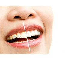 Dentist Forest Hill Brentford Dental Family and Cosmetic Care