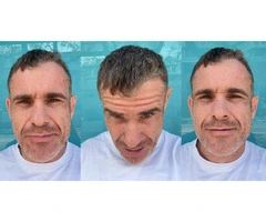 See Why Graham Trusted IHLS for Long-Term Hair Restoration