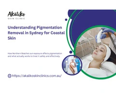 Understanding Your Options for Pigmentation Removal in Sydney