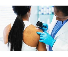 Skin Cancer Clinic Sandringham | Early Checks Matter