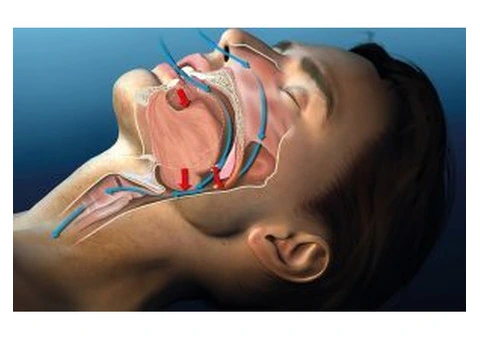 Simple Sleep Apnea Testing in Melbourne at Home Sleep