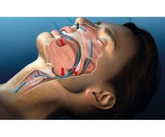 Simple Sleep Apnea Testing in Melbourne at Home Sleep