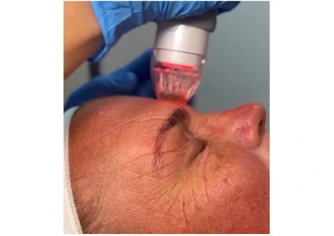 Looking for a Trusted Cosmetic Clinic in Sydney? Discover Natural-Looking Results with Skinnotion - 1/8