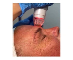 Looking for a Trusted Cosmetic Clinic in Sydney? Discover Natural-Looking Results with Skinnotion