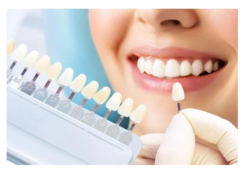 Dental implants winthrop