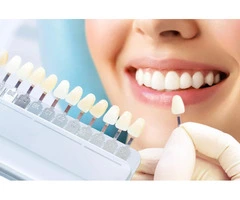Dental implants winthrop