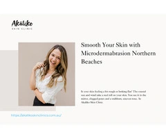 Smooth Your Skin with Microdermabrasion Northern Beaches