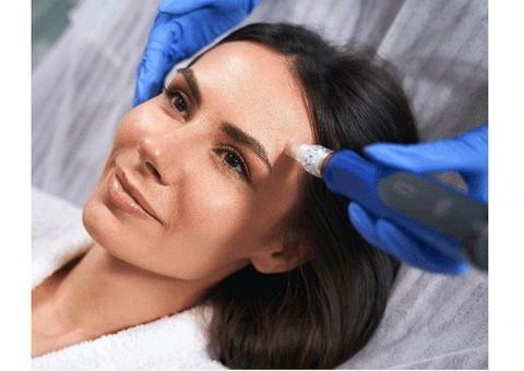 Skin Needling Sydney