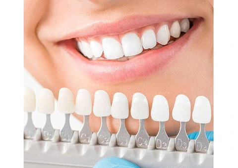 Perfect Smile Treatment by Expert Dentists
