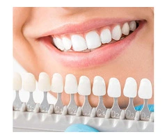 Perfect Smile Treatment by Expert Dentists