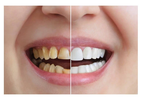 Aesthetic Dentistry for Confident Smiles