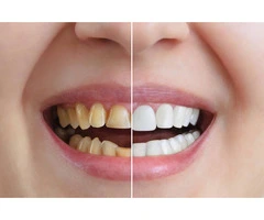 Aesthetic Dentistry for Confident Smiles