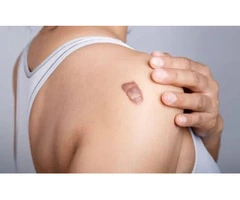 Support Smoother Skin with Keloid Bump Removal Services